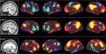 🧠 Ortalama Bir IQ Ne Demektir ve Ne Gösterir? 6 beyin